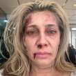 Cynthia Klitbo se integra a ‘médicos’ por sus adicciones